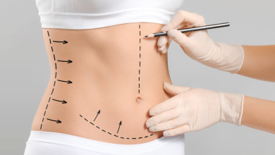 karın liposuction