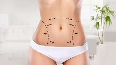 lazer liposuction